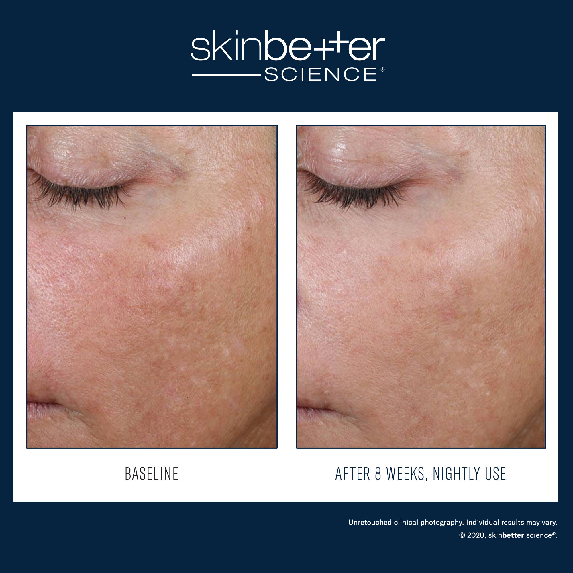 AlphaRet Overnight Cream - Retinoid Cream - SkinBetter Science